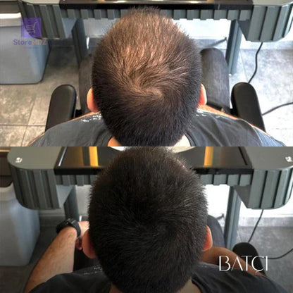 Batçi™ خافي عيوب الشعر للرجال و النساء